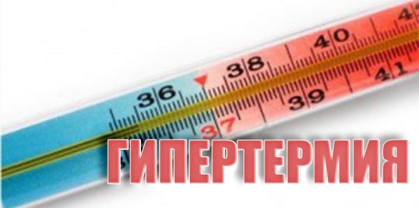 Гипертермия